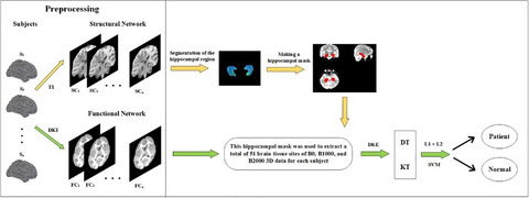 Identifying epilepsy based on machine‐learning technique with diffusion kurtosis tensor