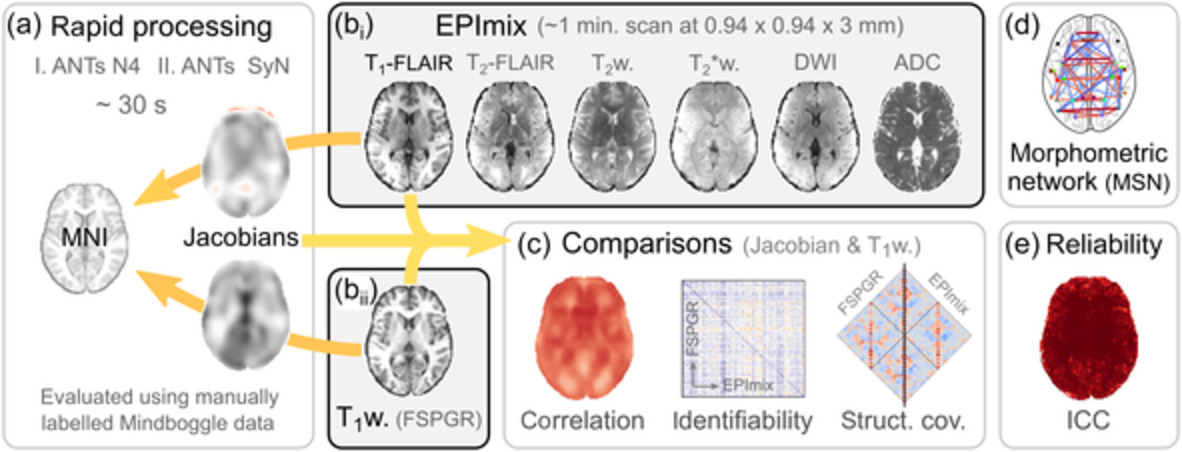 Rapid processing and quantitative evaluation of structural brain scans for adaptive multimodal imaging