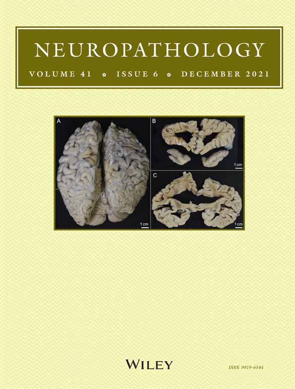 An autopsy case of adult‐onset neuronal intranuclear inclusion disease with perivascular preservation in cerebral white matter