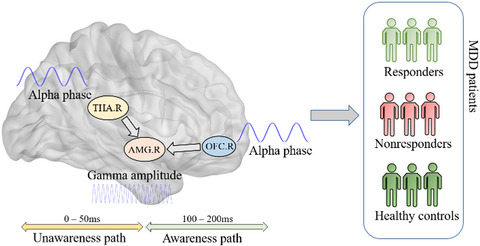 Attenuated alpha–gamma coupling in emotional dual pathways with right‐Amygdala predicting ineffective antidepressant response