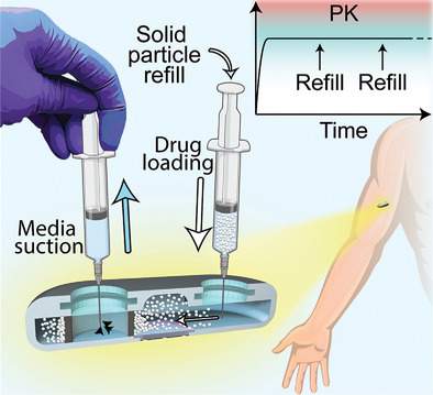 Extending Drug Release from Implants via Transcutaneous Refilling with Solid Therapeutics