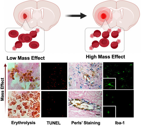 Role of mass effect and trehalose on early erythrolysis after experimental intracerebral hemorrhage