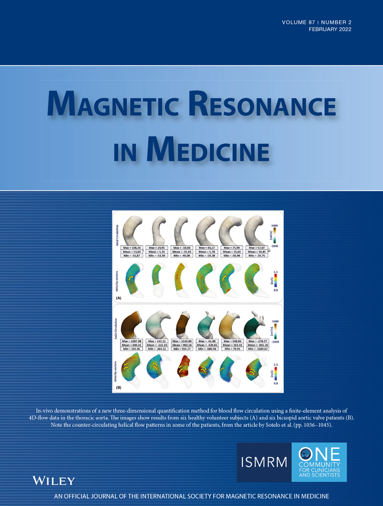 Twenty‐four–channel high‐impedance glove array for hand and wrist MRI at 3T