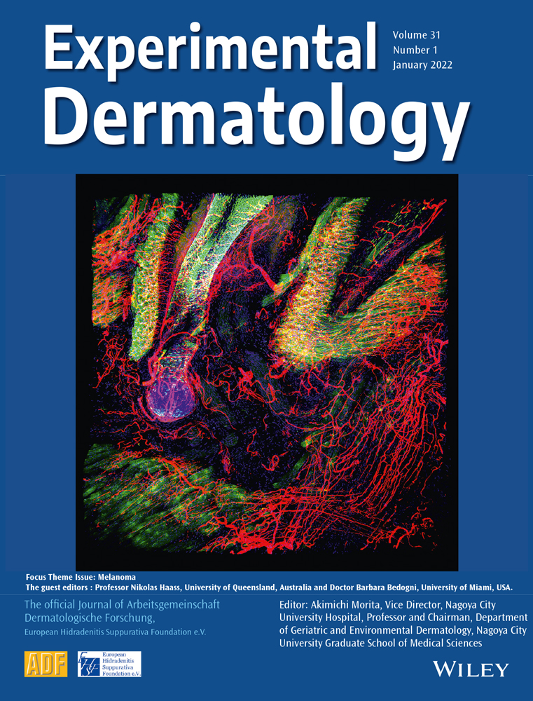 Sorafenib induces pigmentation via the regulation of β‐catenin signalling pathway in melanoma cells