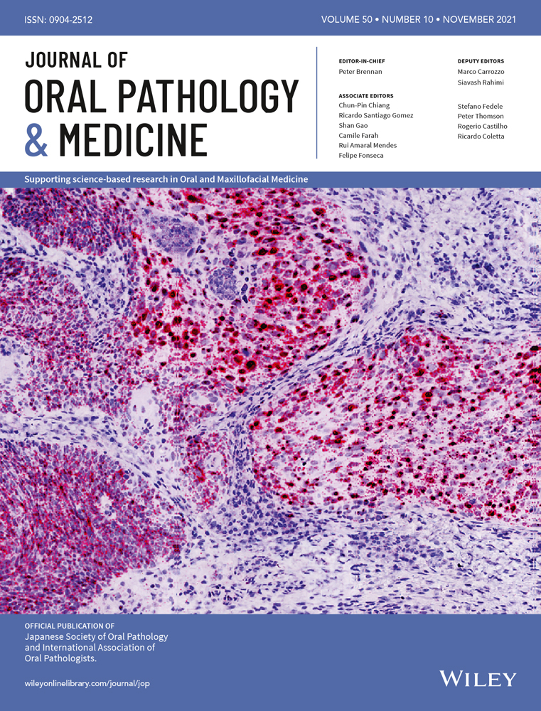 Salivary gland papillary adenocarcinoma with intestinal‐like features: Clinicopathologic, immunohistochemical, and genetic study of six cases