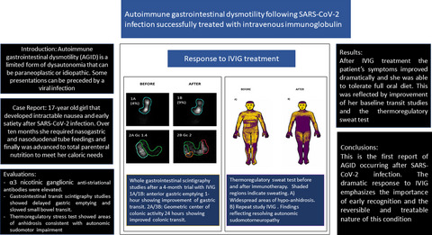 Autoimmune gastrointestinal dysmotility following SARS‐CoV‐2 infection successfully treated with intravenous immunoglobulin