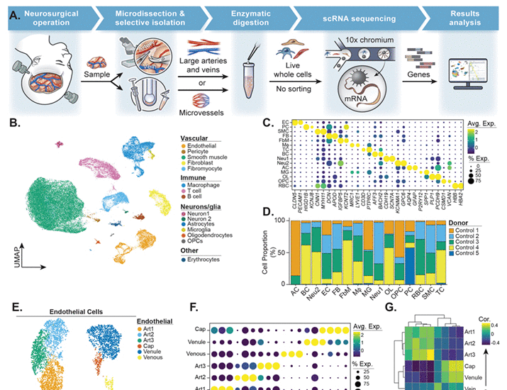 A single-cell atlas of the normal and malformed human brain vasculature