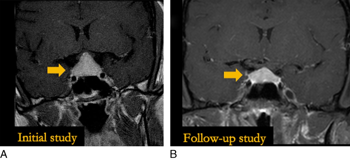 Multimodality Multisystem Imaging of Pregnancy-Related Changes: Featuring Neurologic, Cardiothoracic, Breast, Gynecologic, and Musculoskeletal Issues