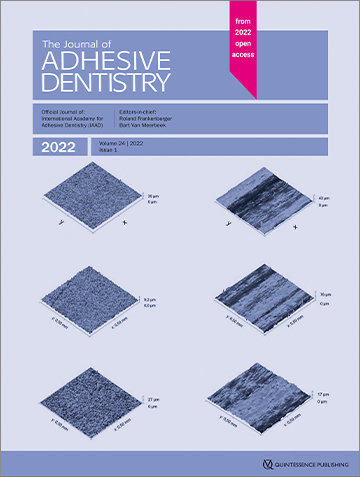 Influence of Dentin Surface Roughness, Drying Time, 
and Primer Application on Self-adhesive Composite-Cement Bond Strength