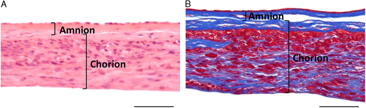 Dehydrated Human Amnion/Chorion Membrane (dHACM) Allografts as a Therapy for Orthopedic Tissue Repair