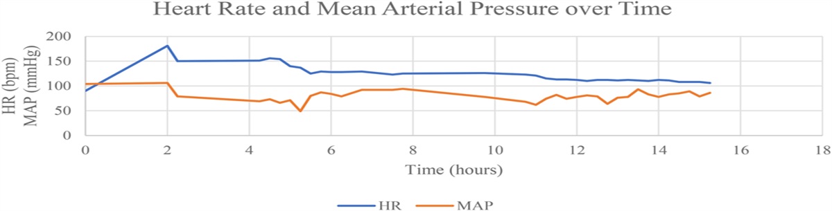 Low-Dose Intravenous Amiodarone-Induced Acute Hepatic Failure