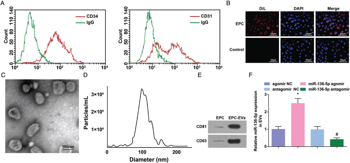 MicroRNA-136-5p from Endothelial Progenitor Cells-released Extracellular Vesicles Mediates TXNIP to Promote the Dissolution of Deep Venous Thrombosis
