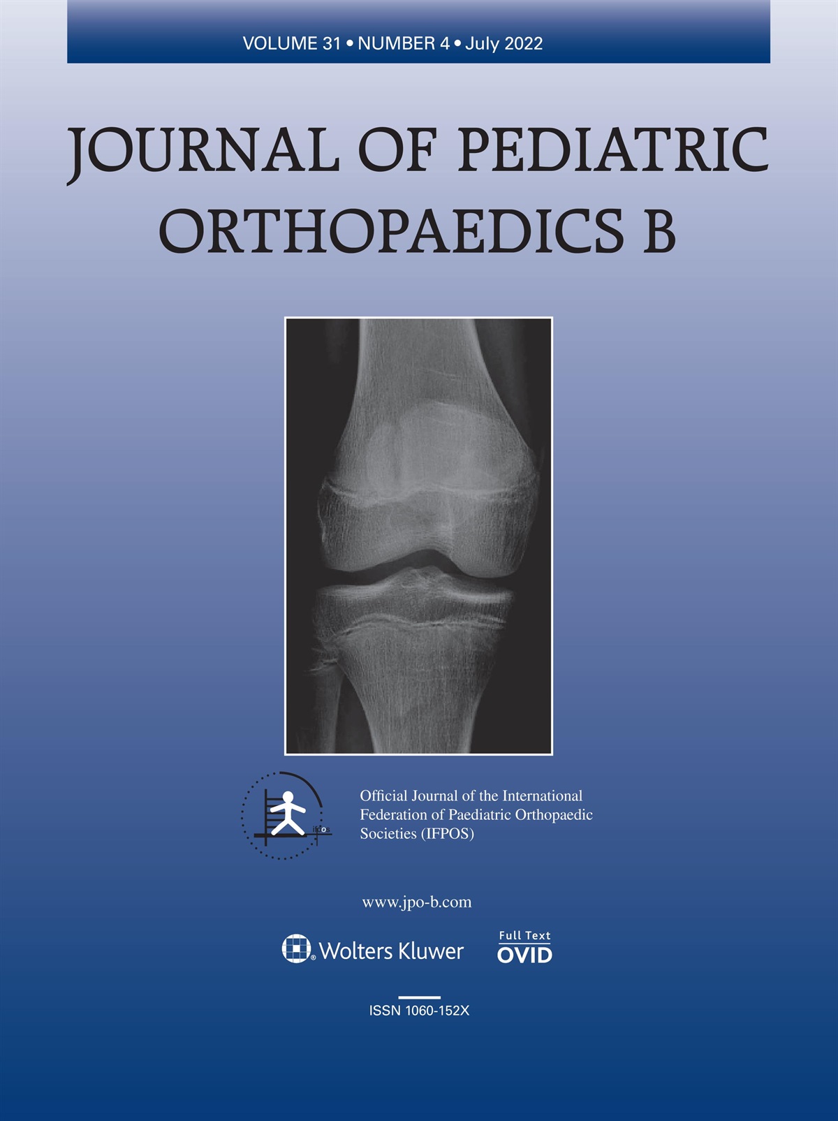 Does compliance with British Orthopaedic Association Standards for Trauma and Orthopaedics guidelines matter for displaced supracondylar fractures in children?: the experience of a tertiary referral major trauma centre over a 3.5-year period