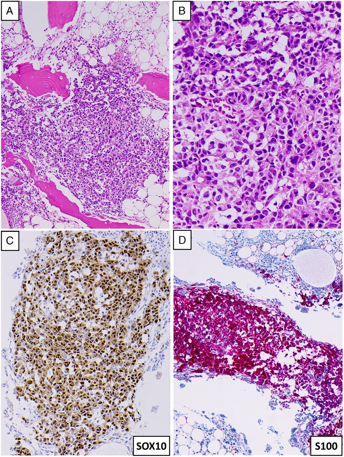 Reporting Critical/Urgent/Significant Results in Anatomic Pathology: The Devil Is in the Details