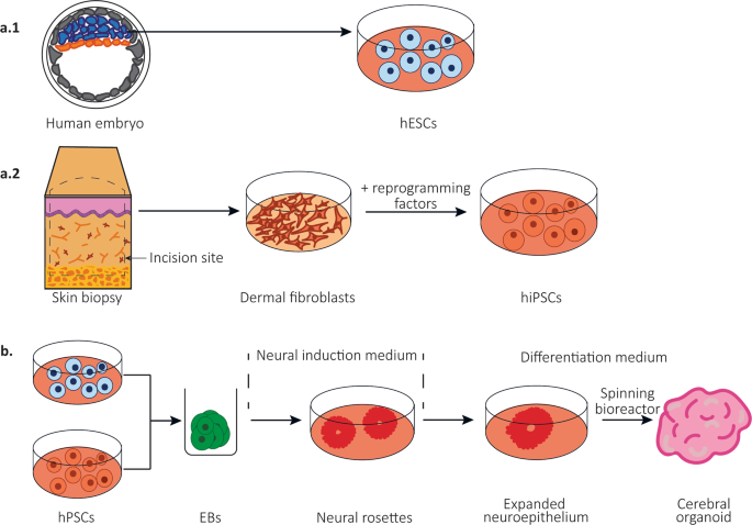 Cerebral organoids as an in vitro model to study autism spectrum disorders