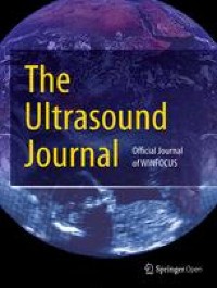 Comparison of four handheld point-of-care ultrasound devices by expert users