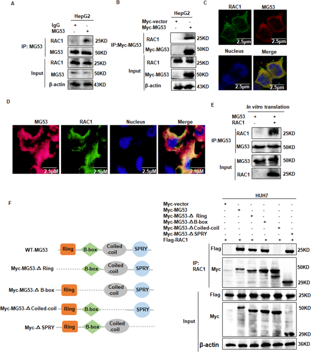 The E3 ubiquitin ligase MG53 inhibits hepatocellular carcinoma by targeting RAC1 signaling