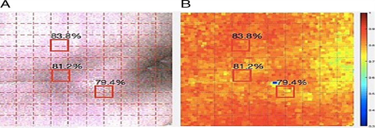 Assessment of Hyperspectral Imaging in Pressure Injury Healing