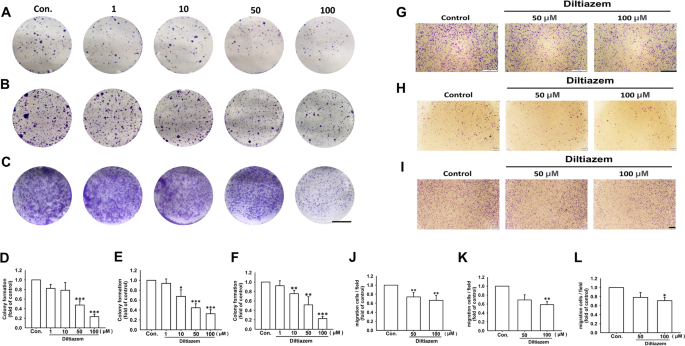Diltiazem inhibits breast cancer metastasis via mediating growth differentiation factor 15 and epithelial-mesenchymal transition