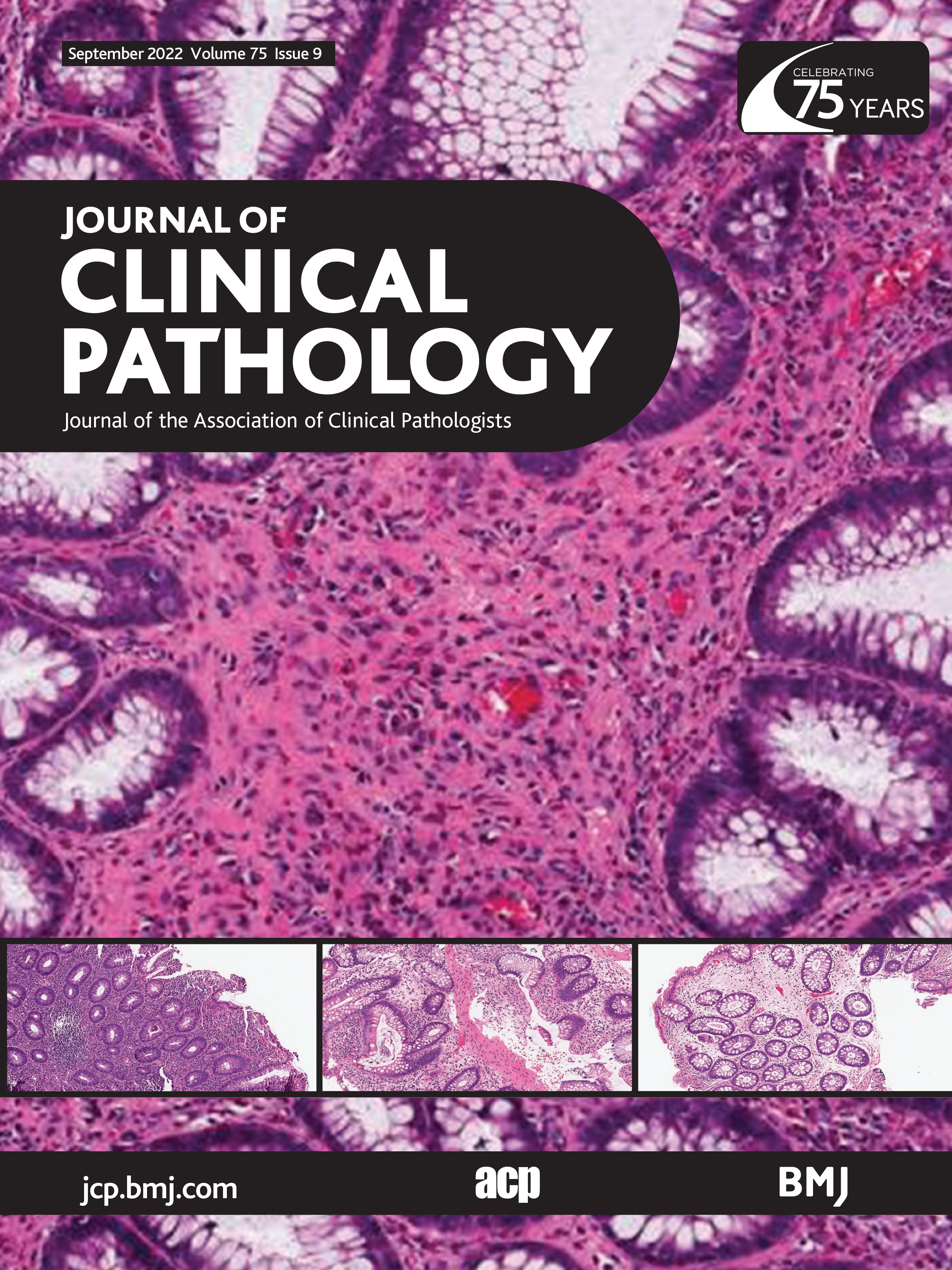 Proteomic characterisations of ulcerative colitis endoscopic biopsies associate with clinically relevant histological measurements of disease severity