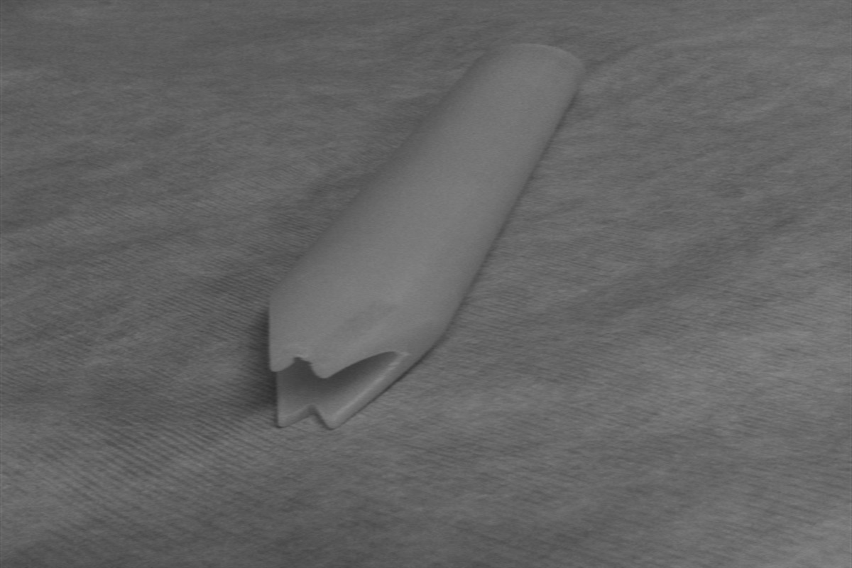 Aid to Femoral Head Removal