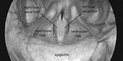Listening for Dysphagia: Voice Quality Sequelae of Material in the Airway