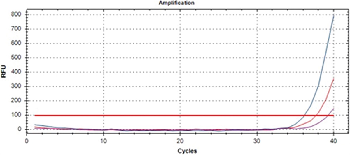 Lab practices that improve coronavirus disease 2019 detection accuracy using real-time PCR