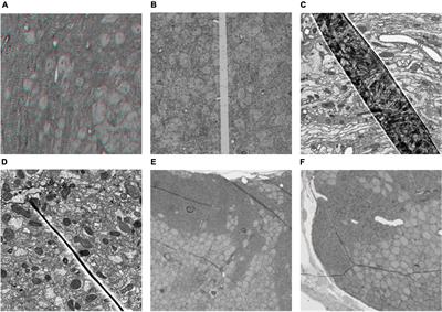 Expected affine: A registration method for damaged section in serial sections electron microscopy