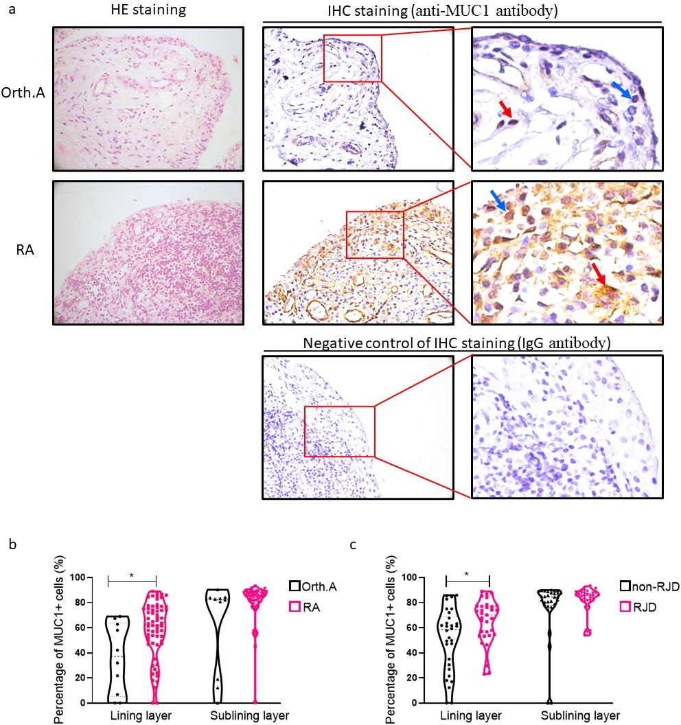 Mucin 1 aggravates synovitis and joint damage of rheumatoid arthritis by regulating inflammation and aggression of fibroblast-like synoviocytes