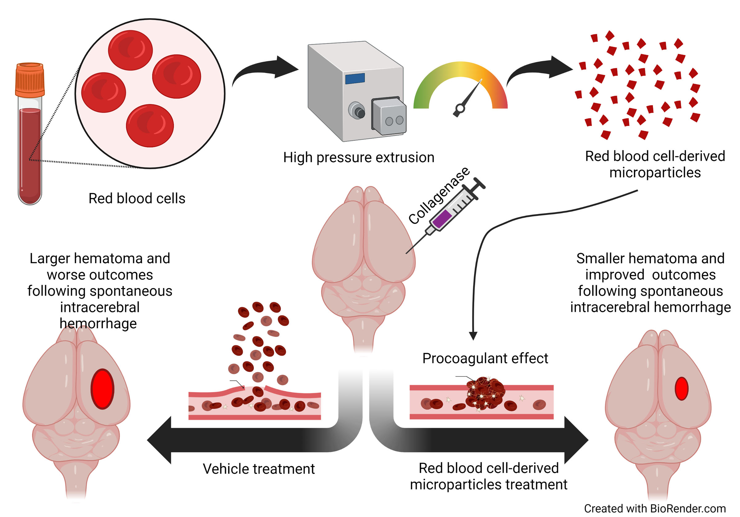 Red Blood Cell Microparticles Limit Hematoma Growth in Intracerebral Hemorrhage