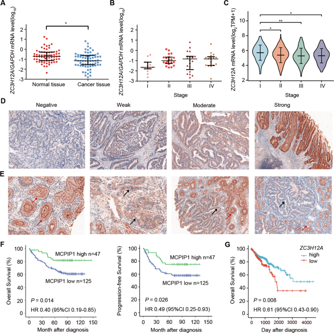 MCPIP1 Suppresses the NF-κB Signaling Pathway Through Negative Regulation of K63-Linked Ubiquitylation of TRAF6 in Colorectal Cancer