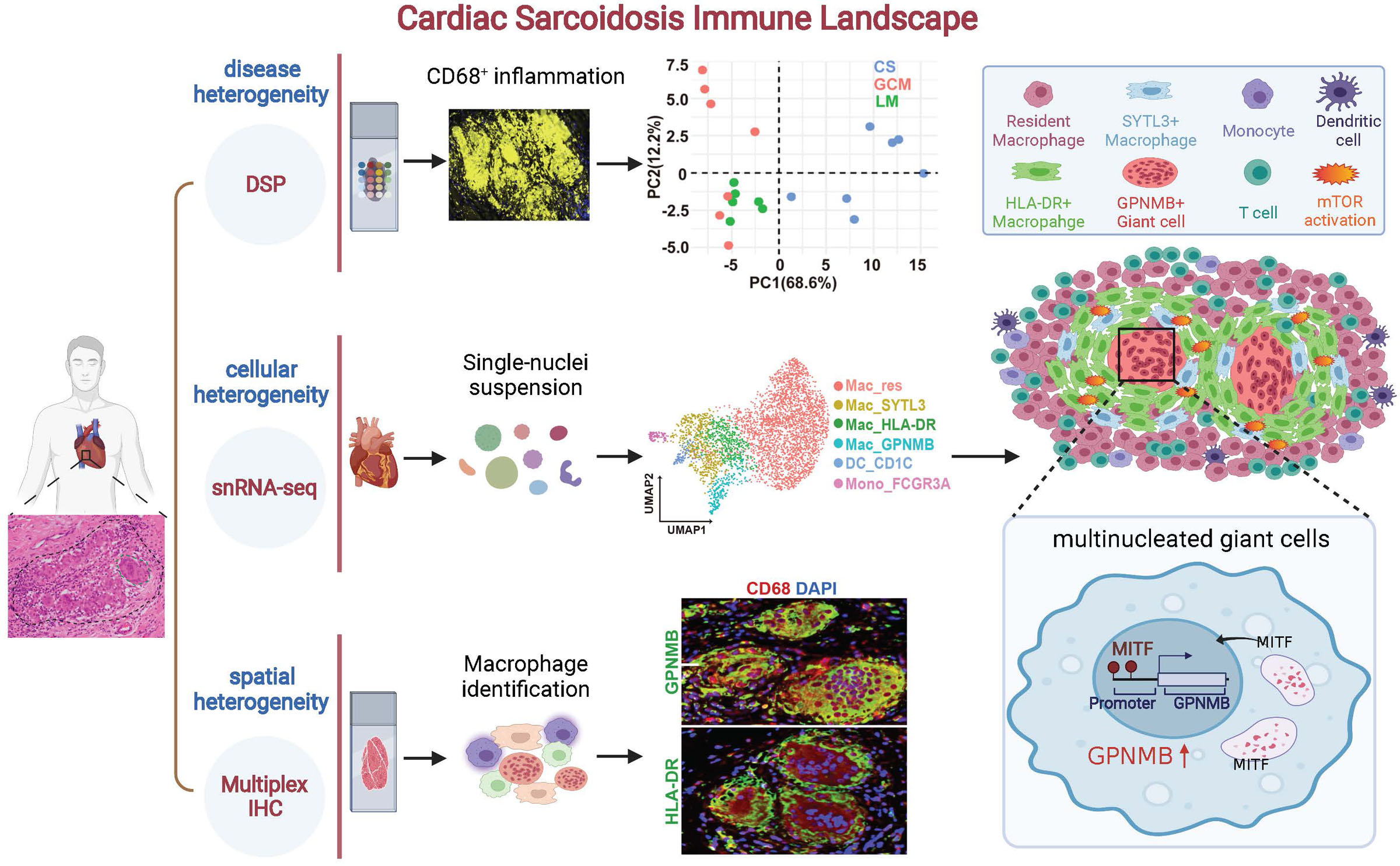Transcriptional and Immune Landscape of Cardiac Sarcoidosis