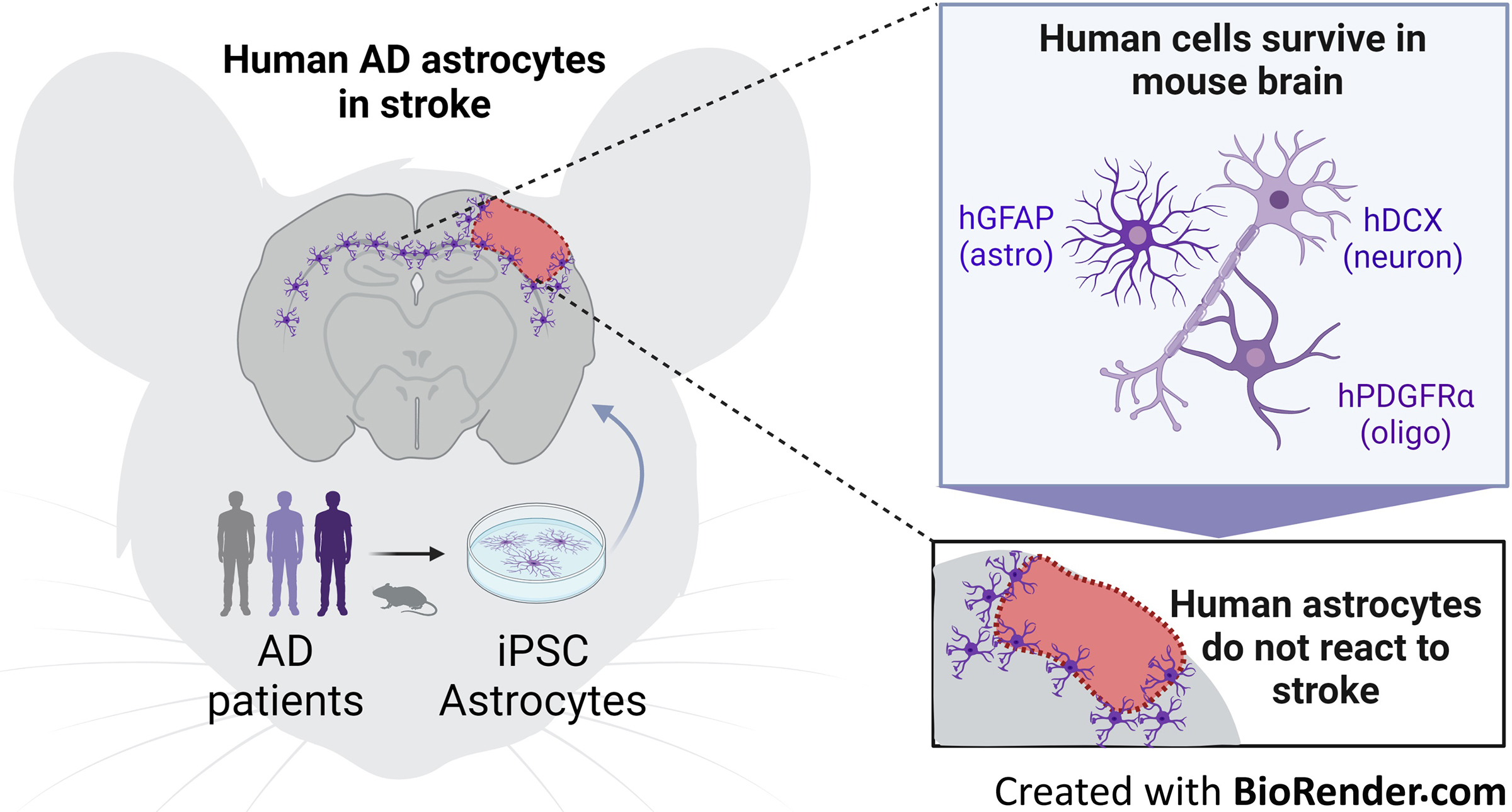 Astrocyte Progenitors Derived From Patients With Alzheimer Disease Do Not Impair Stroke Recovery in Mice