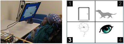 Challenges of brain-computer interface facilitated cognitive assessment for children with cerebral palsy