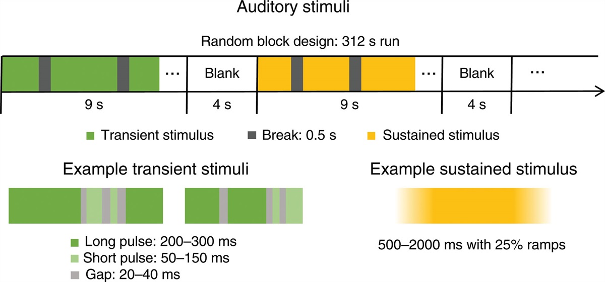 A specialized channel for encoding auditory transients in the magnocellular division of the human medial geniculate nucleus
