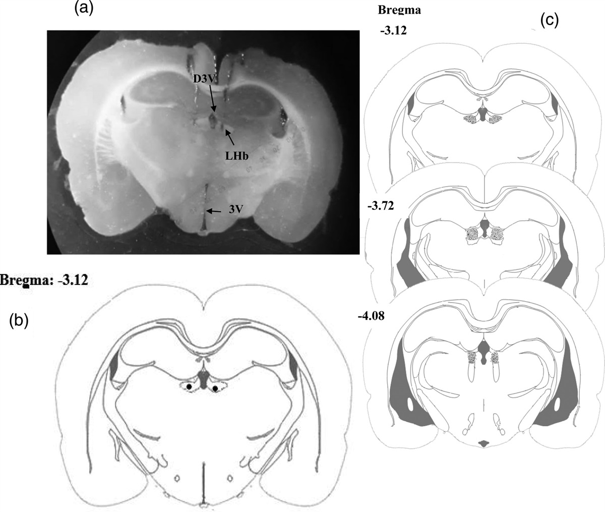 Involvement of GABAA receptors of lateral habenula in the acquisition and expression phases of morphine-induced place preference in male rats