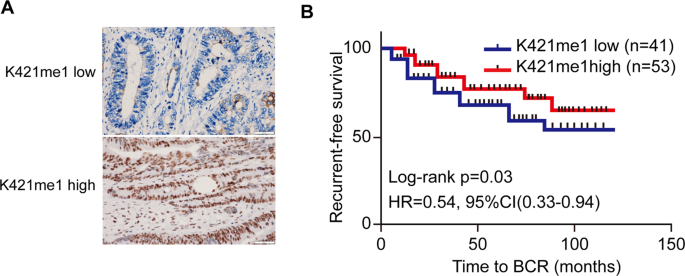 SMYD3 regulates gastric cancer progression and macrophage polarization through EZH2 methylation