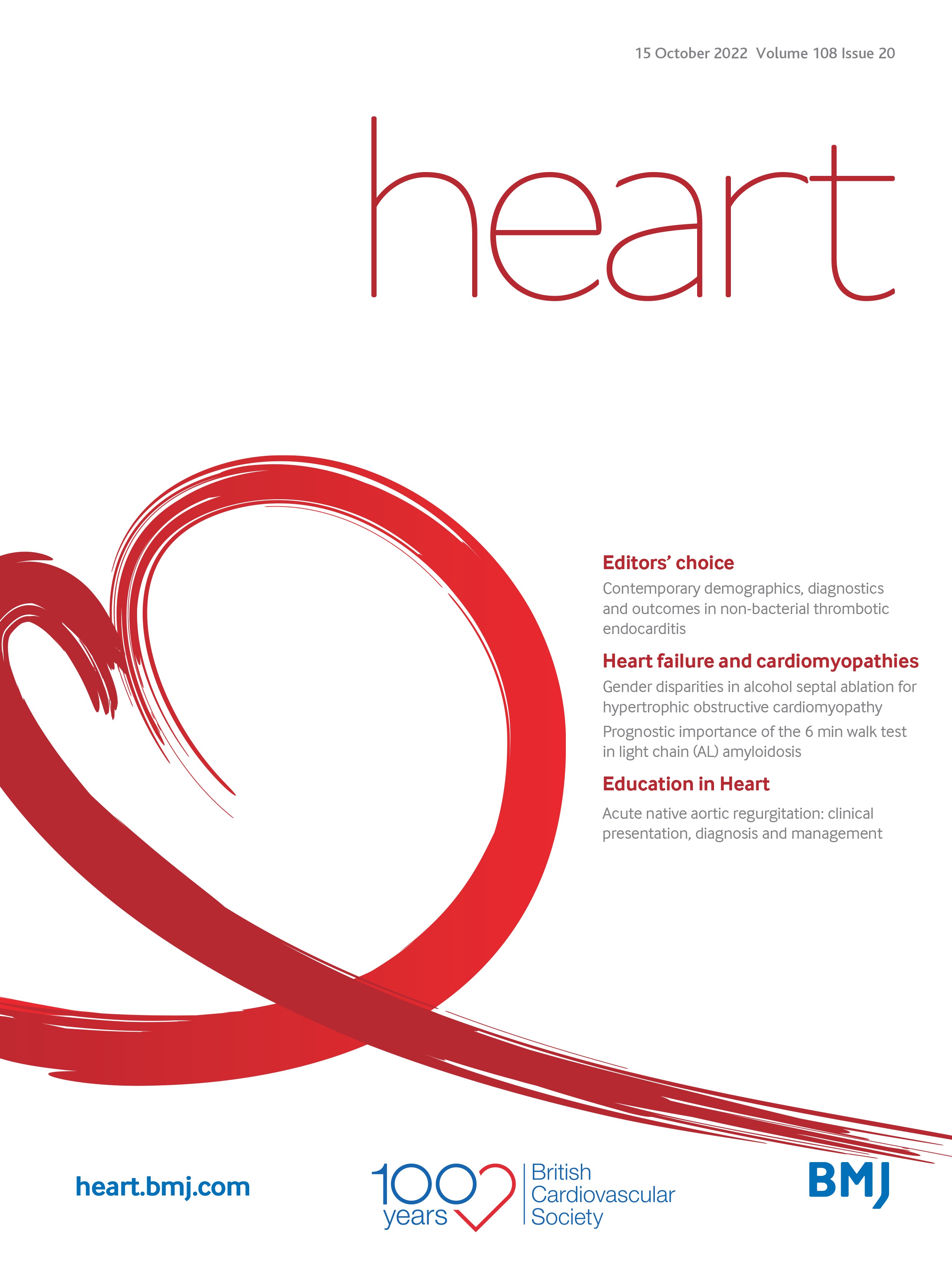 Acute native aortic regurgitation: clinical presentation, diagnosis and management