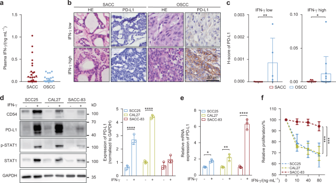 Interferon-γ induces immunosuppression in salivary adenoid cystic carcinoma by regulating programmed death ligand 1 secretion
