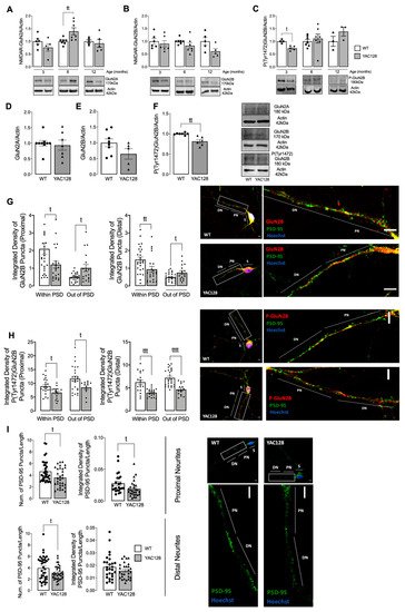 Cells, Vol. 11, Pages 3063: Restored Fyn Levels in Huntington’s Disease Contributes to Enhanced Synaptic GluN2B-Composed NMDA Receptors and CREB Activity