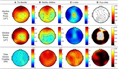 Association of resting-state theta–gamma coupling with selective visual attention in children with tic disorders