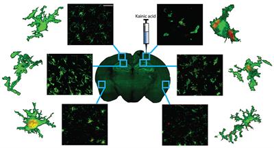 Reactive morphology of dividing microglia following kainic acid administration