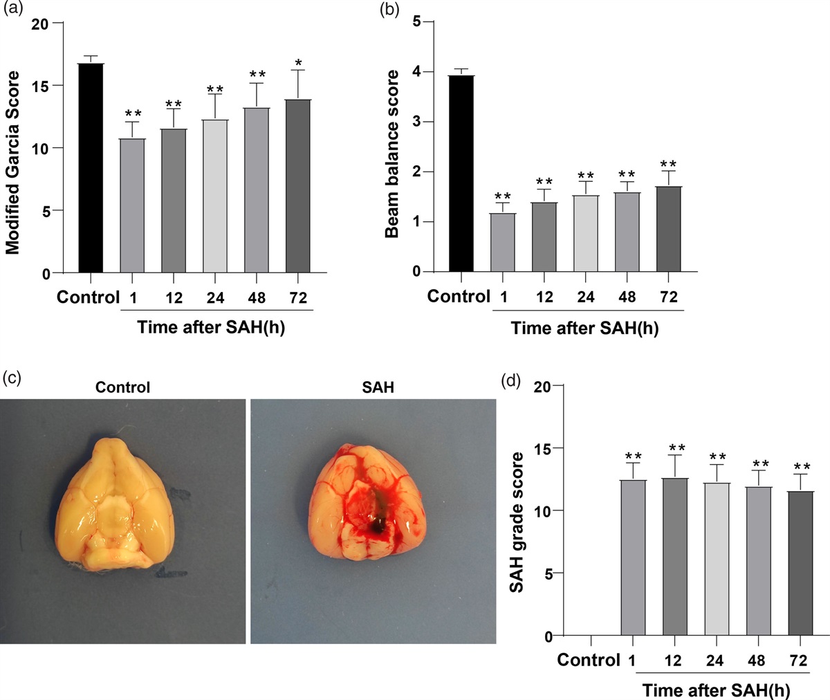 Knockdown of sortilin improves the neurological injury and regional cerebral blood flow in rats after subarachnoid hemorrhage