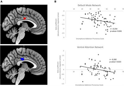 Altered resting-state functional connectivity of the dorsal anterior cingulate cortex with intrinsic brain networks in male problematic smartphone users