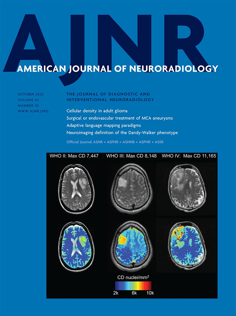 Application of 7T MRS to High-Grade Gliomas [ADULT BRAIN]