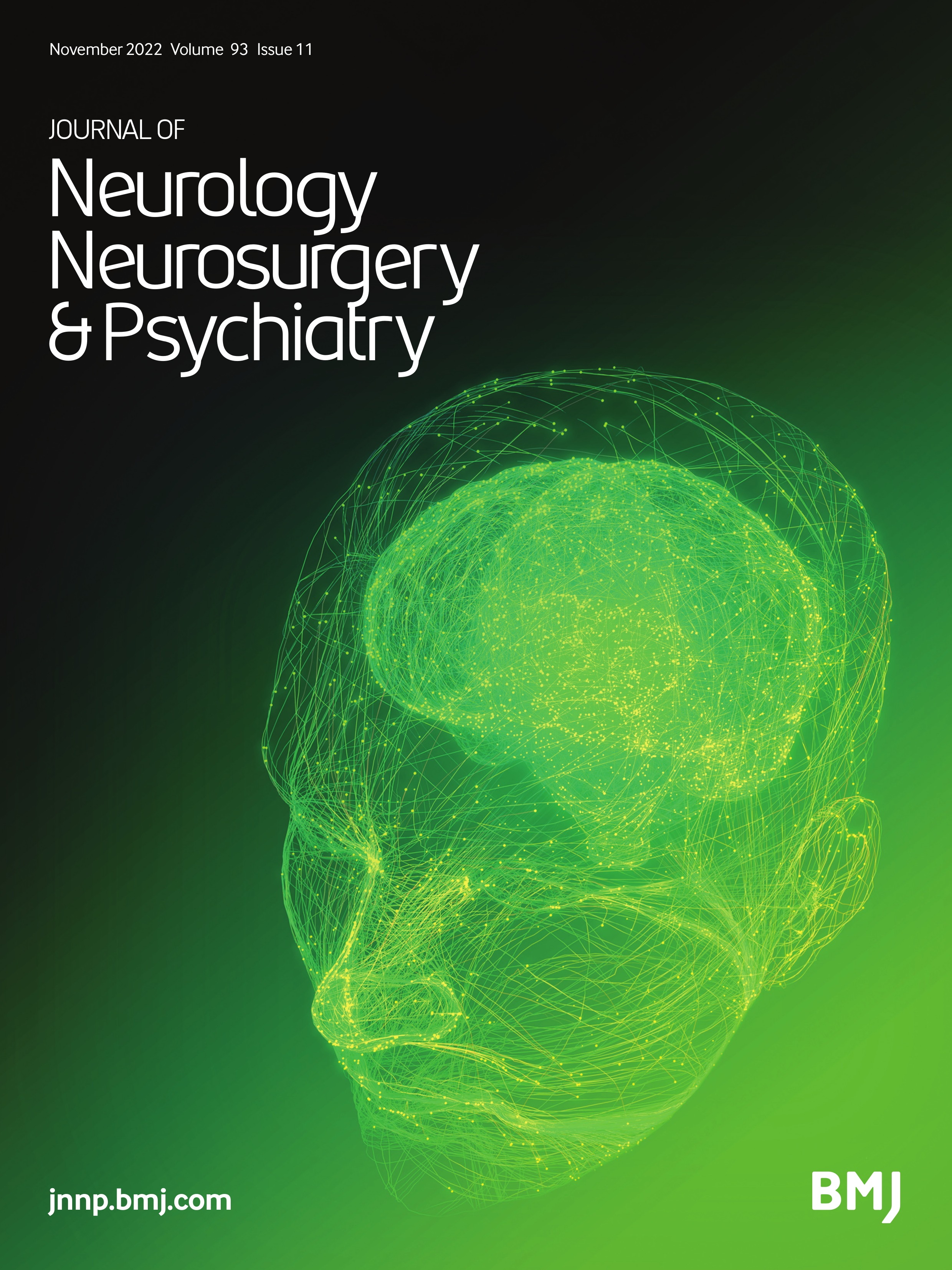 Force dependency of benign paroxysmal positional vertigo in acute traumatic brain injury: a prospective study