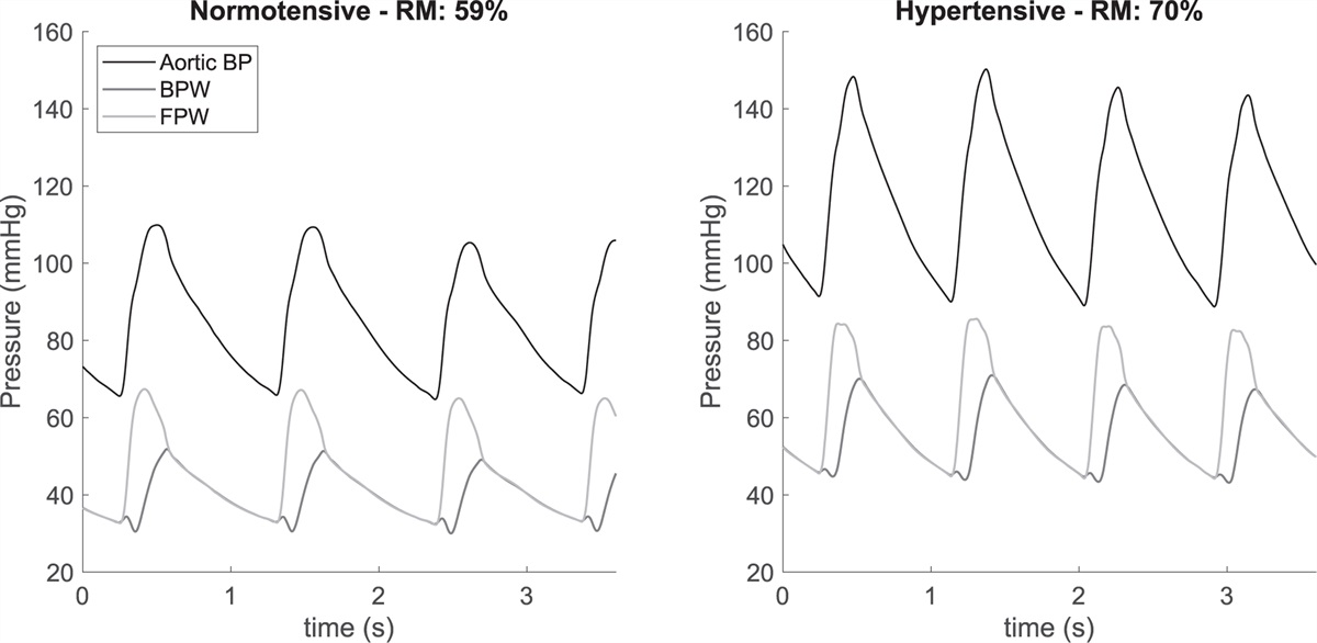 Association between the reflection magnitude and blood pressure in a multiethnic cohort: the Healthy Life in an Urban Setting study