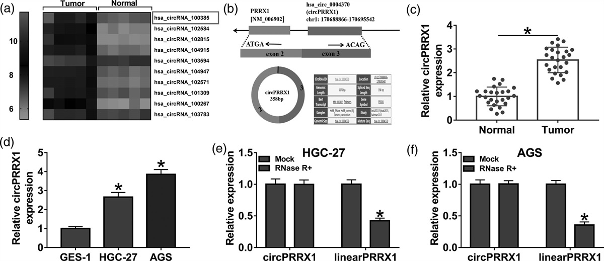 Exosomal circPRRX1 functions as a ceRNA for miR-596 to promote the proliferation, migration, invasion, and reduce radiation sensitivity of gastric cancer cells via the upregulation of NF-κB activating protein