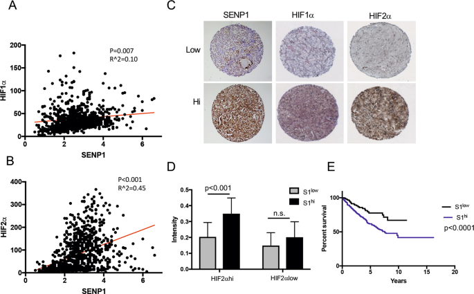 The SUMO protease SENP1 promotes aggressive behaviors of high HIF2α expressing renal cell carcinoma cells