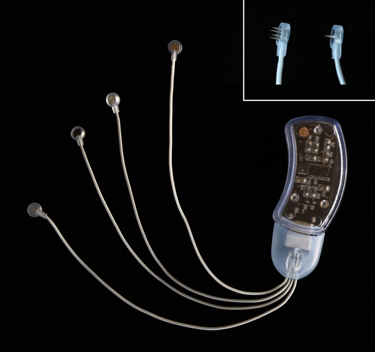 Percutaneous Auricular Nerve Stimulation (Neuromodulation) for Analgesia and Opioid-Sparing Following Knee and Hip Arthroplasty: A Proof-of-Concept Case Series